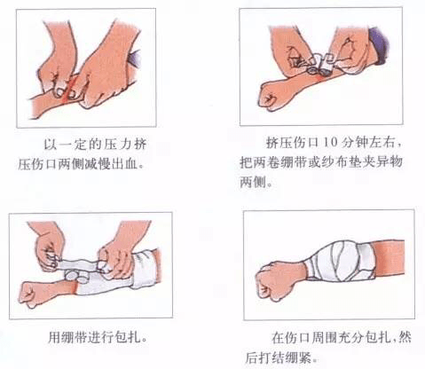 家庭外伤消毒与包扎的急救步骤指南