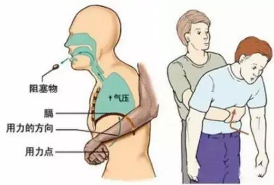 家庭急救指南，眼睛异物处理方法与步骤详解